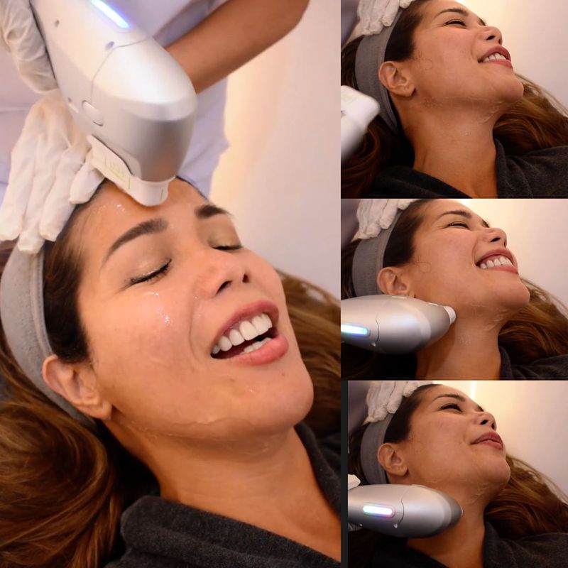 HIFU Non-Surgical Facelift HIFU